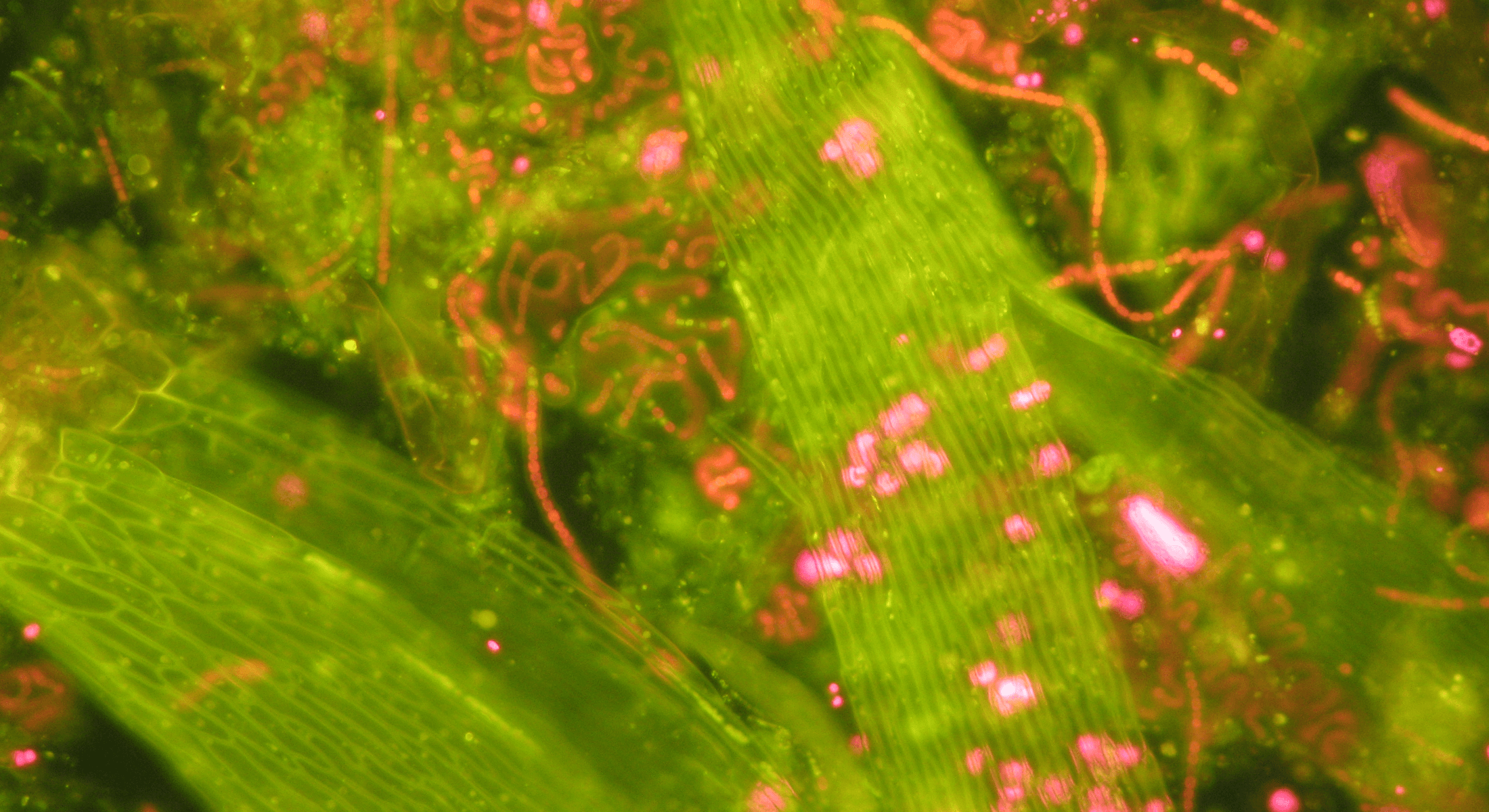 Fluorescent microscope picture showing cyanobacteria (red) in and around moss (green)